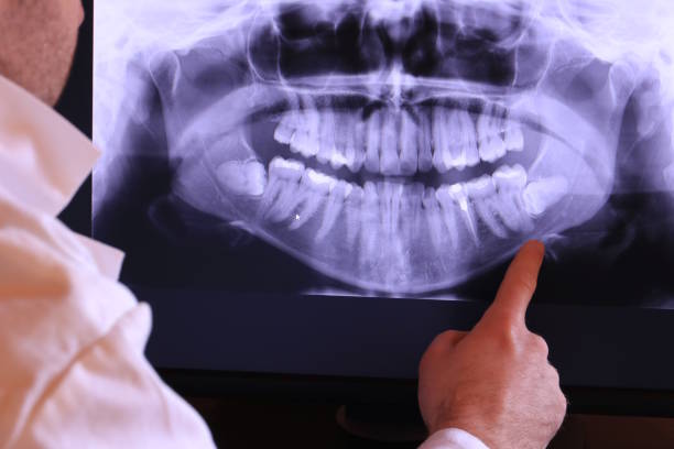 Best Emergency Root Canal Treatment in Hancock, MD
