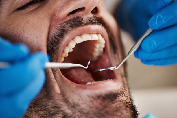 Best Urgent Care for Lost Fillings or Crowns in Hancock, MD